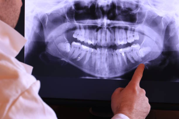 Best Pediatric Emergency Dentist in Prospect, OH