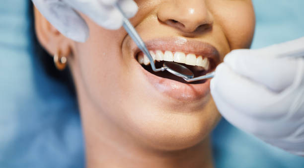 Best Emergency Dental Care for Broken or Chipped Teeth in Prospect, OH